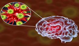 Ученые доказали, что коронавирус повреждает мозг. Какие последствия?
