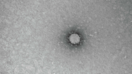 Ученые нашли мутации коронавируса, устойчивые к антителам