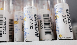 В России зарегистрировали тест на антитела у болевших COVID-19 бессимптомно