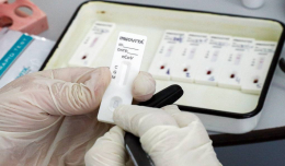 В СФ намерены расширить программу диспансеризации тестированием на антитела к коронавирусу