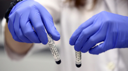 В ВОЗ объяснили, почему не стоит полагаться на антитела перед вакцинацией