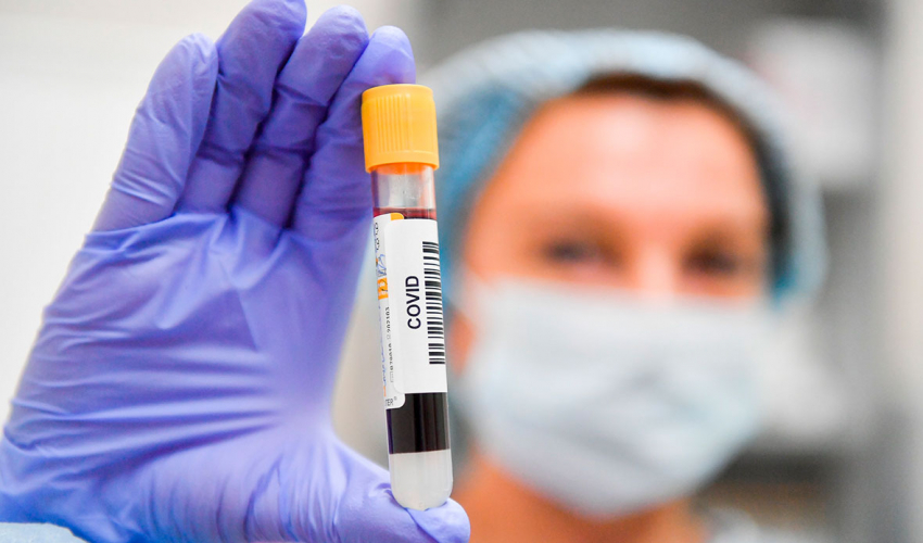 В России провели больше 20 млн тестов на коронавирус